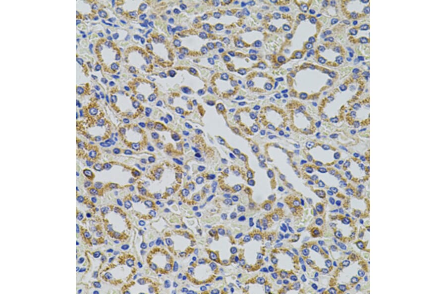 Immunohistochemistry - Anti-HTF9C/TRMT2A Antibody (A90944) - Antibodies.com