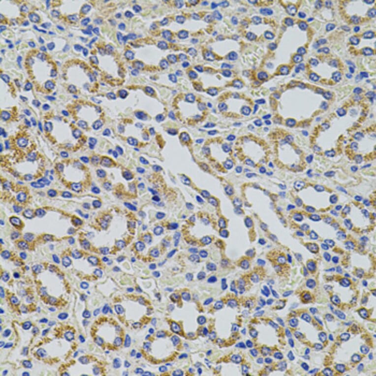 Immunohistochemistry - Anti-HTF9C/TRMT2A Antibody (A90944) - Antibodies.com