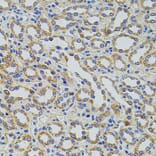 Immunohistochemistry - Anti-HTF9C/TRMT2A Antibody (A90944) - Antibodies.com