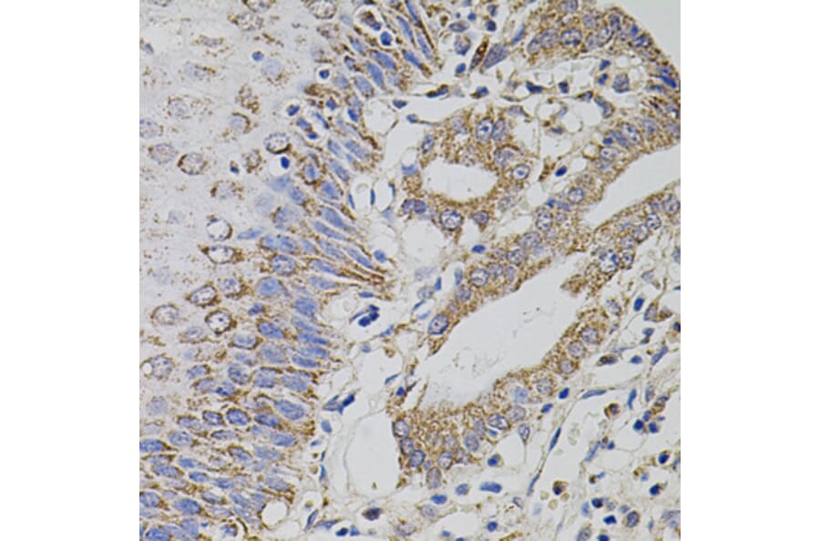 Immunohistochemistry - Anti-HTF9C/TRMT2A Antibody (A90944) - Antibodies.com