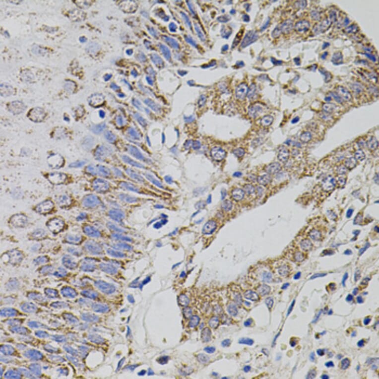 Immunohistochemistry - Anti-HTF9C/TRMT2A Antibody (A90944) - Antibodies.com