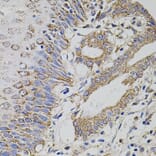 Immunohistochemistry - Anti-HTF9C/TRMT2A Antibody (A90944) - Antibodies.com