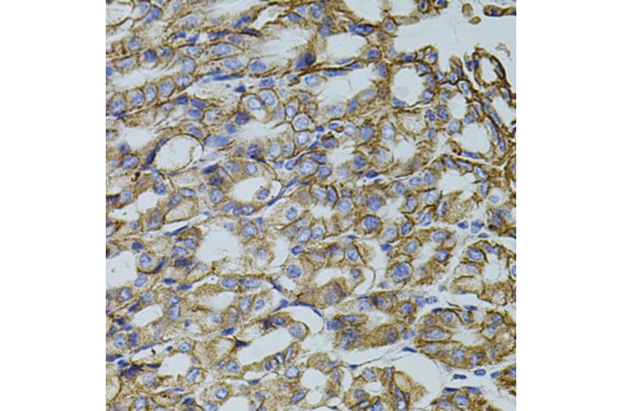 Immunohistochemistry - Anti-HTF9C/TRMT2A Antibody (A90944) - Antibodies.com