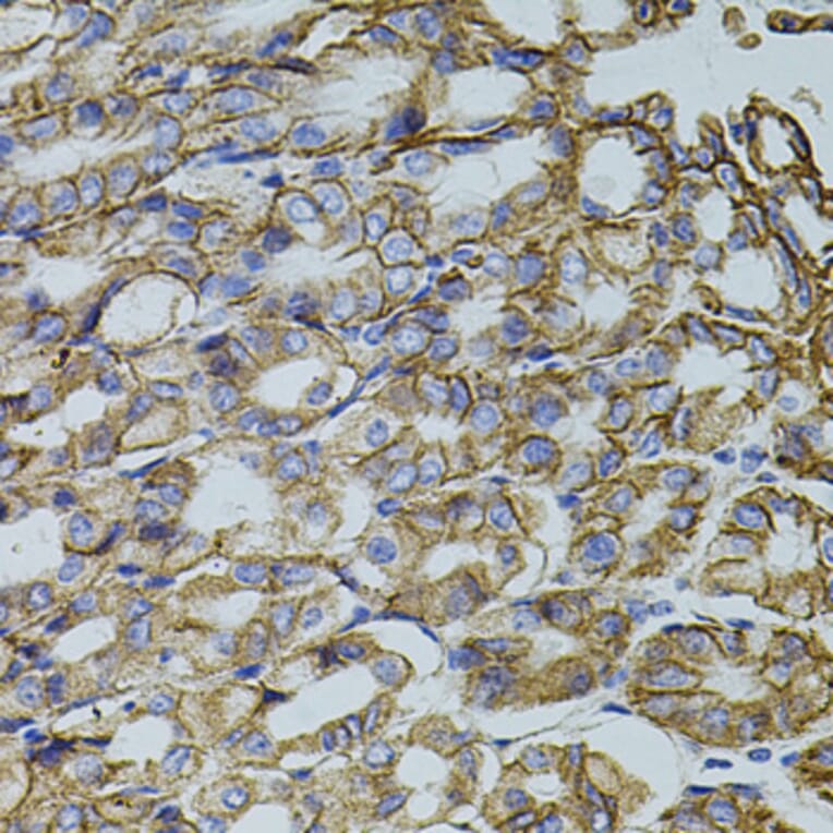 Immunohistochemistry - Anti-HTF9C/TRMT2A Antibody (A90944) - Antibodies.com