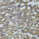 Immunohistochemistry - Anti-HTF9C/TRMT2A Antibody (A90944) - Antibodies.com