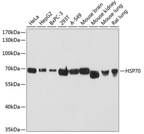 Western Blot - Anti-HSP70 Antibody (A90945) - Antibodies.com