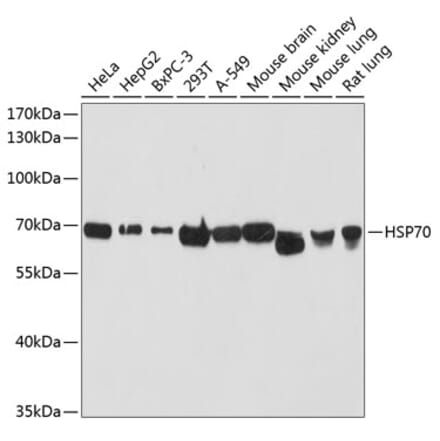 Western Blot - Anti-HSP70 Antibody (A90945) - Antibodies.com