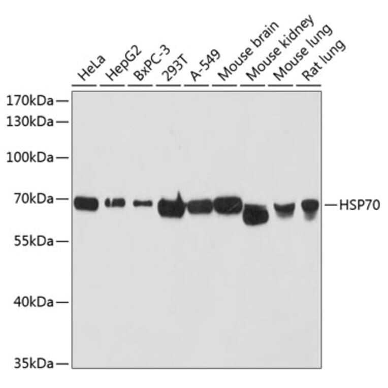 Western Blot - Anti-HSP70 Antibody (A90945) - Antibodies.com