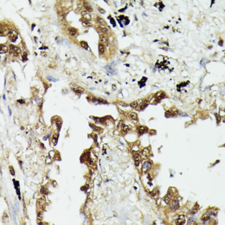 Immunohistochemistry - Anti-HSP70 Antibody (A90945) - Antibodies.com