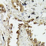 Immunohistochemistry - Anti-HSP70 Antibody (A90945) - Antibodies.com