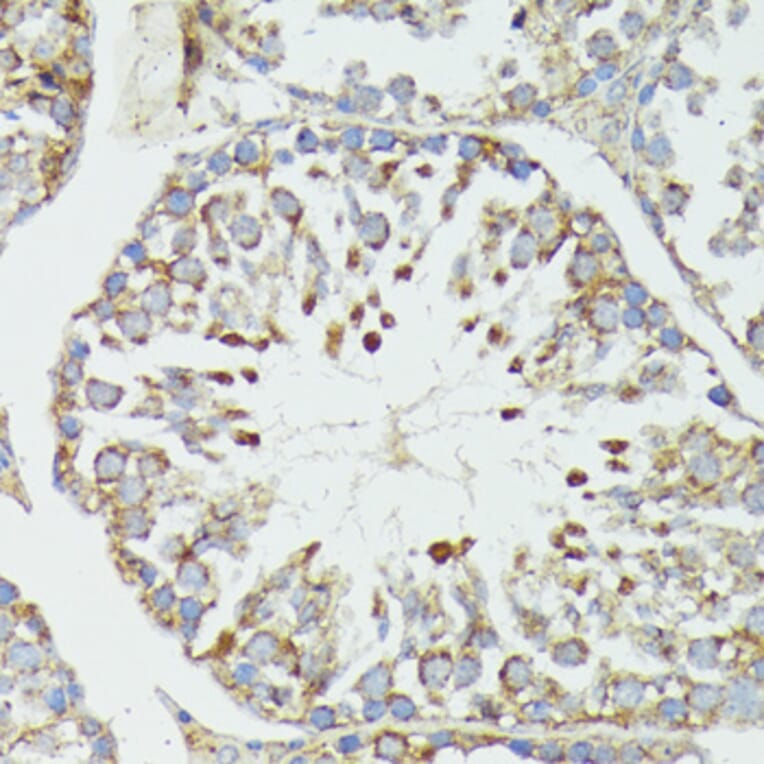 Immunohistochemistry - Anti-HSP70 Antibody (A90945) - Antibodies.com