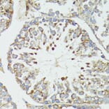 Immunohistochemistry - Anti-HSP70 Antibody (A90945) - Antibodies.com