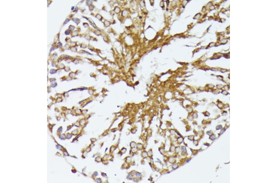 Immunohistochemistry - Anti-HSP70 Antibody (A90945) - Antibodies.com