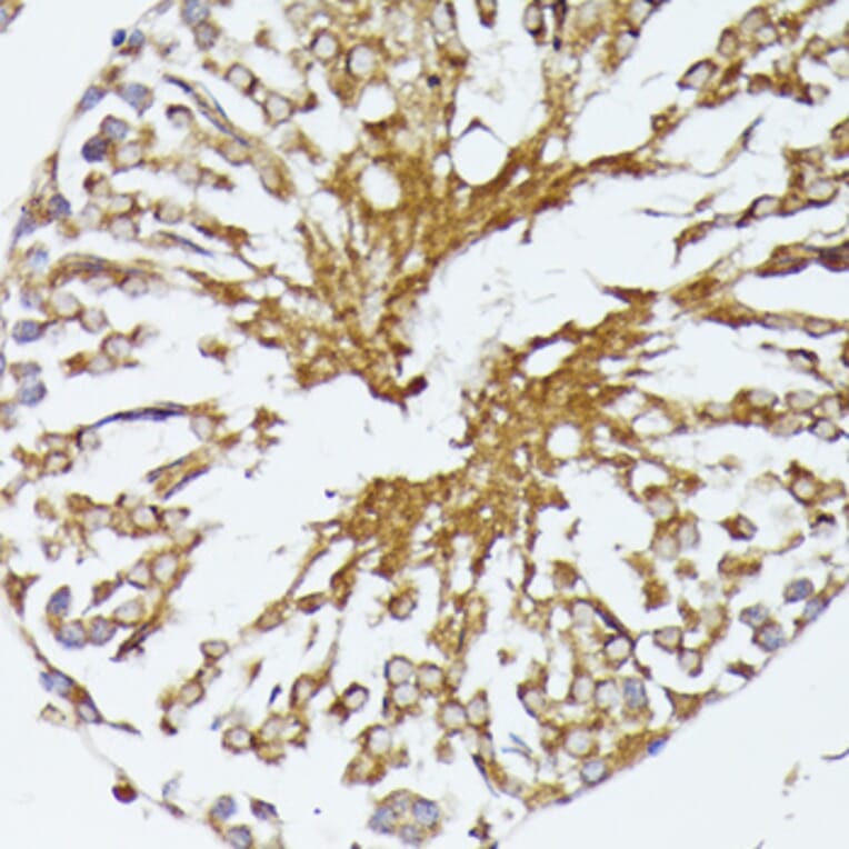 Immunohistochemistry - Anti-HSP70 Antibody (A90945) - Antibodies.com