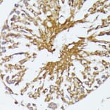 Immunohistochemistry - Anti-HSP70 Antibody (A90945) - Antibodies.com