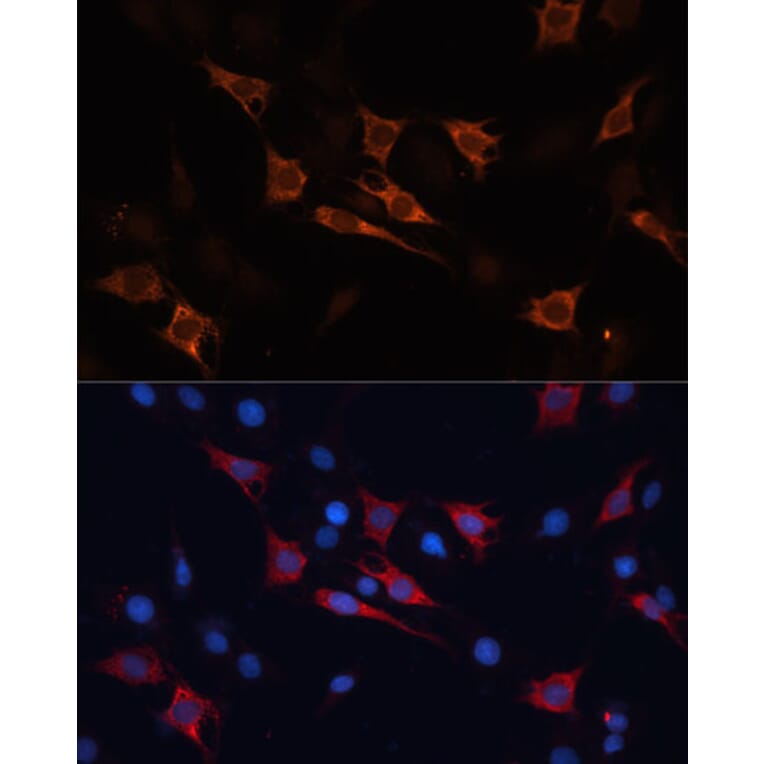 Immunofluorescence - Anti-HSP70 Antibody (A90945) - Antibodies.com