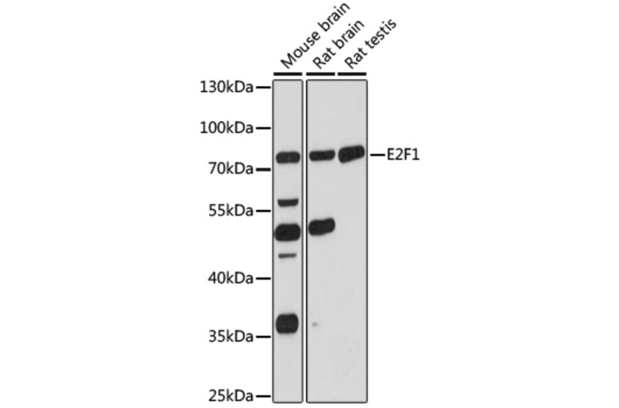 Western Blot - Anti-E2F1 Antibody (A90946) - Antibodies.com