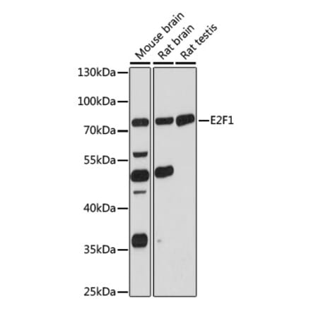 Western Blot - Anti-E2F1 Antibody (A90946) - Antibodies.com