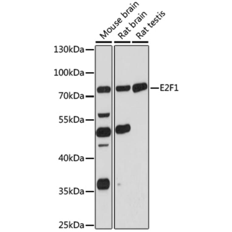 Western Blot - Anti-E2F1 Antibody (A90946) - Antibodies.com