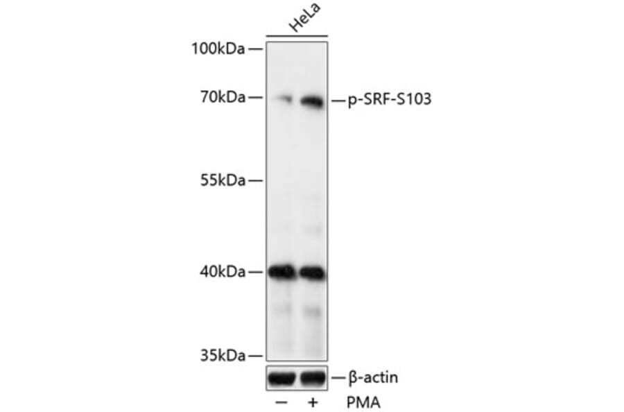 Western Blot - Anti-Serum Response Factor/SRF (phospho Ser103) Antibody (A90947) - Antibodies.com