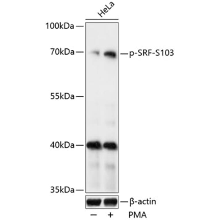 Western Blot - Anti-Serum Response Factor/SRF (phospho Ser103) Antibody (A90947) - Antibodies.com