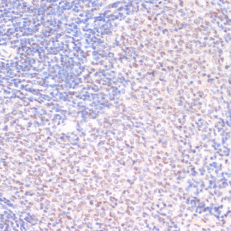 Immunohistochemistry - Anti-Serum Response Factor/SRF (phospho Ser103) Antibody (A90947) - Antibodies.com