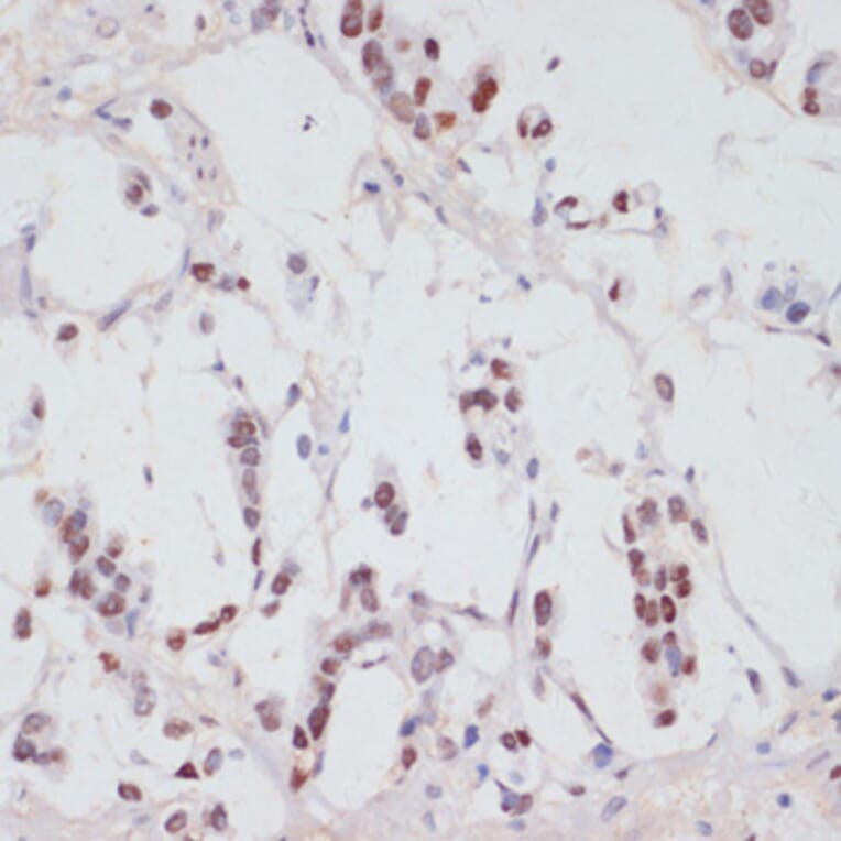 Immunohistochemistry - Anti-Serum Response Factor/SRF (phospho Ser103) Antibody (A90947) - Antibodies.com