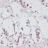 Immunohistochemistry - Anti-Serum Response Factor/SRF (phospho Ser103) Antibody (A90947) - Antibodies.com