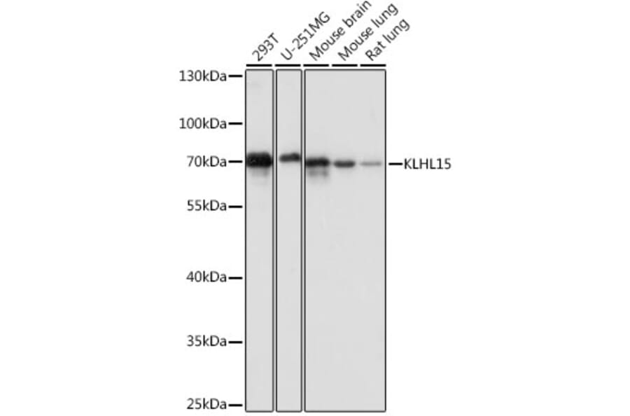 Western Blot - Anti-KLHL15 Antibody (A90948) - Antibodies.com