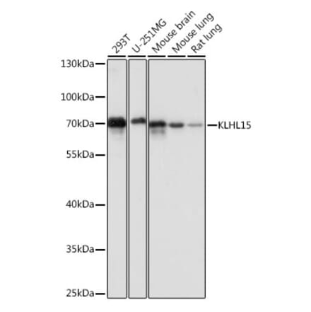 Western Blot - Anti-KLHL15 Antibody (A90948) - Antibodies.com