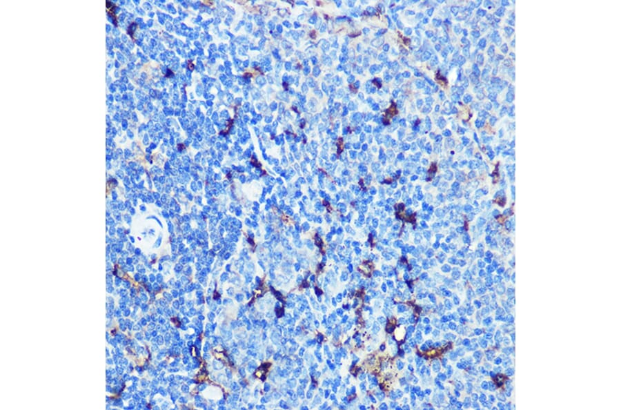 Immunohistochemistry - Anti-SLAMF7/CS1 Antibody (A90949) - Antibodies.com