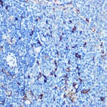 Immunohistochemistry - Anti-SLAMF7/CS1 Antibody (A90949) - Antibodies.com