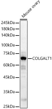 Western blot analysis of extracts of various cell lines, using Anti-COLGALT1 Antibody (A16571) at 1:1,000 dilution.
Secondary antibody: Goat Anti-Rabbit IgG (H+L) (HRP) (AS014) at 1:10,000 dilution.
Lysates / proteins: 25µg per lane.
Blocking buffer: 3% non-fat dry milk in TBST.
Detection: ECL Basic Kit (RM00020).
Exposure time: 10s.
