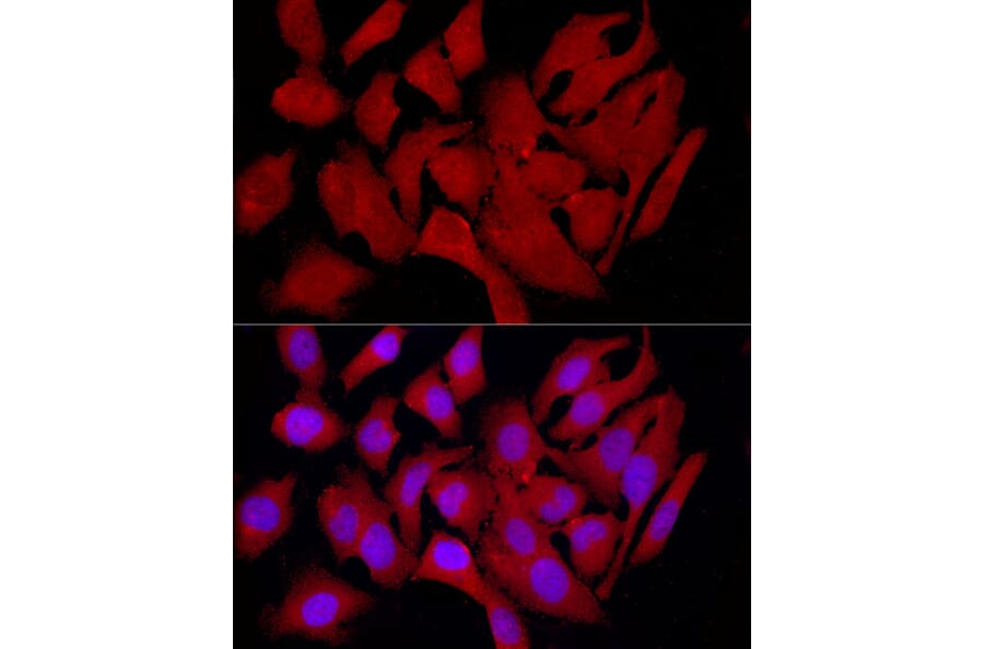 Immunofluorescence - Anti-COLGALT1/GLT25D1 Antibody (A90950) - Antibodies.com