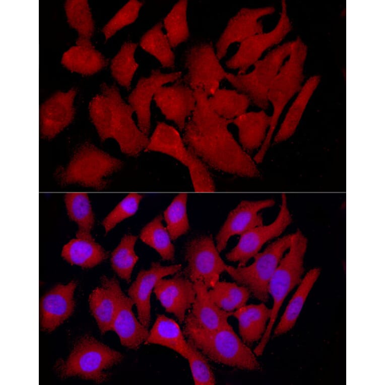Immunofluorescence - Anti-COLGALT1/GLT25D1 Antibody (A90950) - Antibodies.com