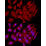 Immunofluorescence - Anti-COLGALT1/GLT25D1 Antibody (A90950) - Antibodies.com