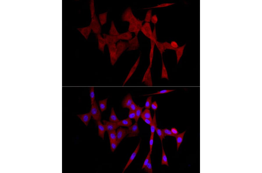 Immunofluorescence - Anti-COLGALT1/GLT25D1 Antibody (A90950) - Antibodies.com
