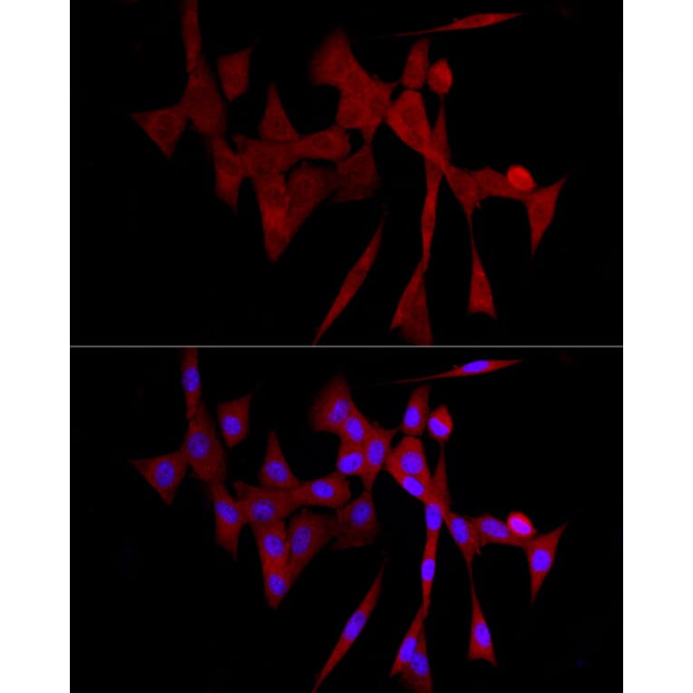 Immunofluorescence - Anti-COLGALT1/GLT25D1 Antibody (A90950) - Antibodies.com