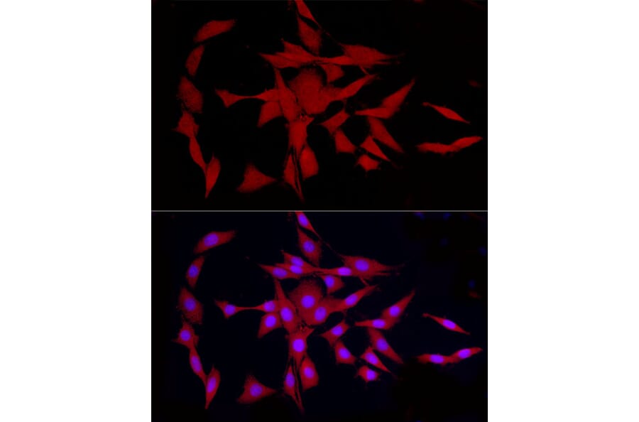 Immunofluorescence - Anti-COLGALT1/GLT25D1 Antibody (A90950) - Antibodies.com