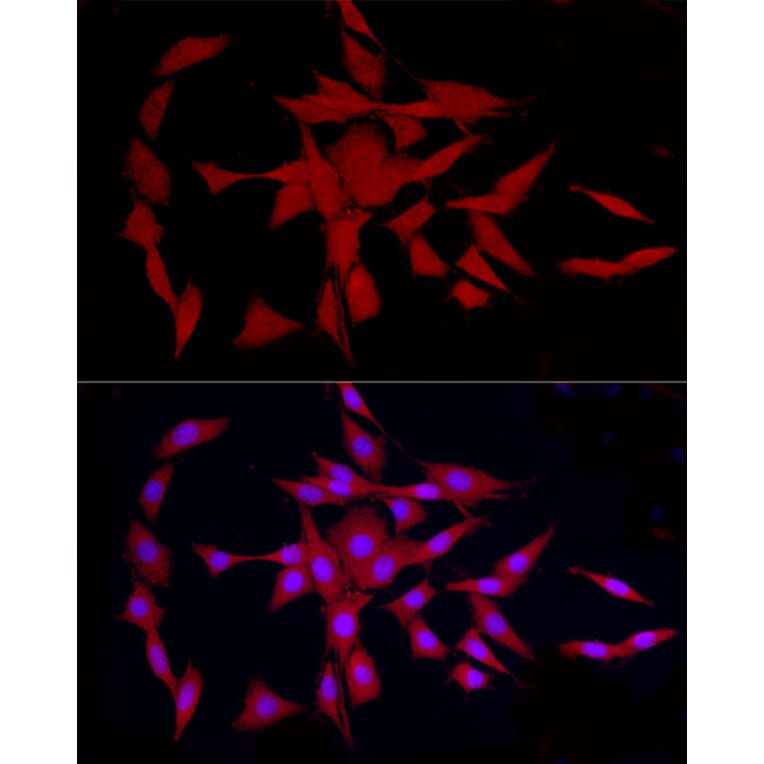 Immunofluorescence - Anti-COLGALT1/GLT25D1 Antibody (A90950) - Antibodies.com