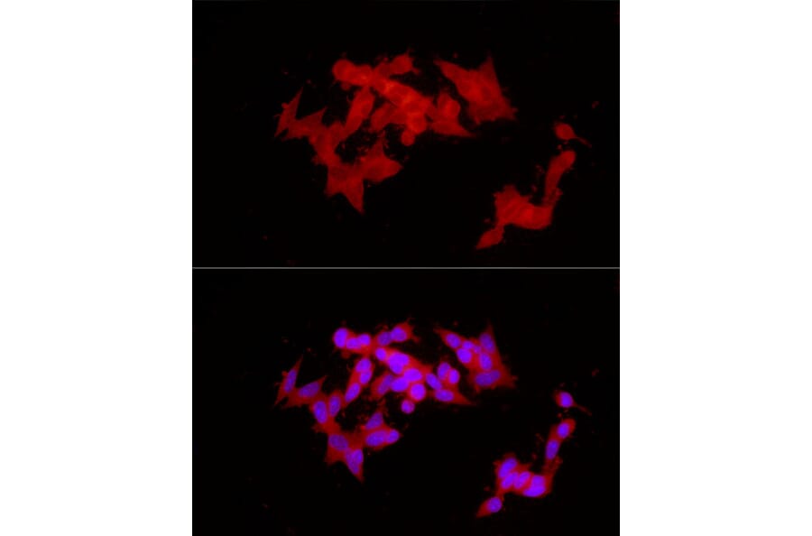 Immunofluorescence - Anti-COLGALT1/GLT25D1 Antibody (A90950) - Antibodies.com