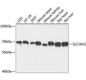 Western Blot - Anti-MCT 8 Antibody (A90951) - Antibodies.com