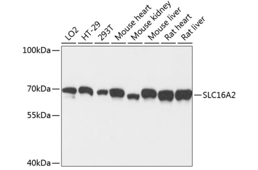 Western Blot - Anti-MCT 8 Antibody (A90951) - Antibodies.com
