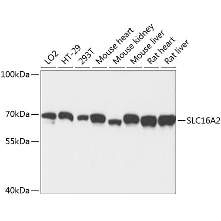 Western Blot - Anti-MCT 8 Antibody (A90951) - Antibodies.com