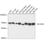 Western Blot - Anti-MCT 8 Antibody (A90951) - Antibodies.com