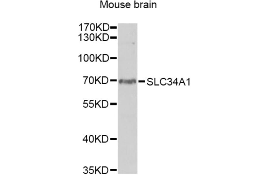 Western Blot - Anti-SLC34A1 Antibody (A13634) - Antibodies.com