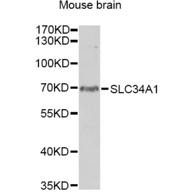 Western Blot - Anti-SLC34A1 Antibody (A13634) - Antibodies.com