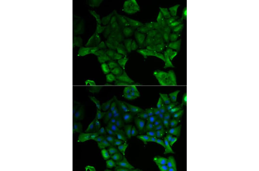 Immunofluorescence - Anti-SLC34A1 Antibody (A13634) - Antibodies.com