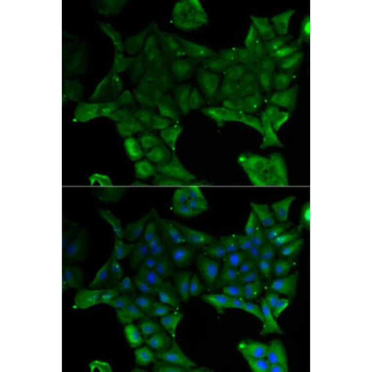 Immunofluorescence - Anti-SLC34A1 Antibody (A13634) - Antibodies.com