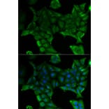 Immunofluorescence - Anti-SLC34A1 Antibody (A13634) - Antibodies.com